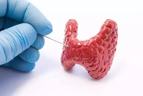 甲状腺疾病，包括甲状腺功能减退和甲状腺功能亢进，自古以来就是反复被医学研究人员研究的疾病