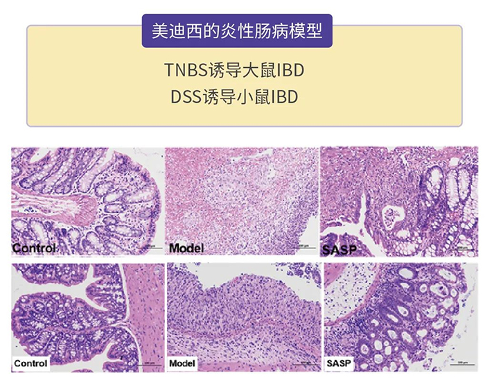 尊龙凯时的炎性肠病模型.png 尊龙凯时的炎性肠病模型.png